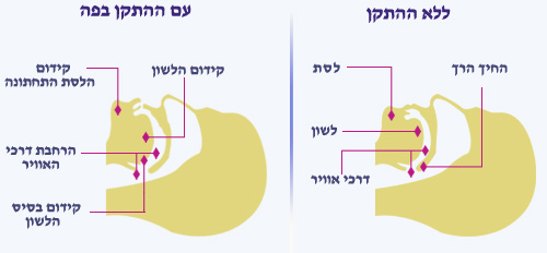 סד דנטלי
