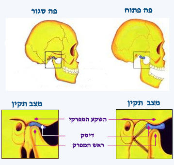 הפרעות במערכת הלעיסה